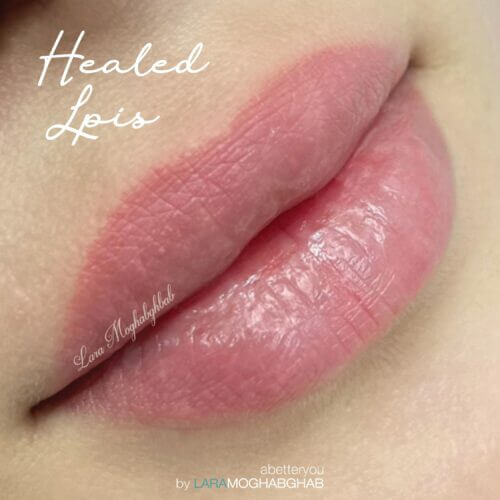 Healed Lip Blush